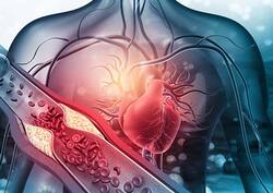 Coronavirus Update: Is COVID-19 Virus Causing Heart Attacks In India? Health Ministry Set To Investigate