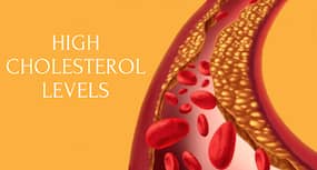 7 Amazing Home Remedies for High Cholesterol