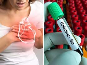 कोलेस्ट्रॉल करना चाहते हमेशा के लिए कंट्रोल तो भूलकर भी ना करें ये 4 गलतियां