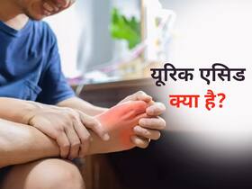 यूरिक एसिड क्या है, इसके लक्षण कारण और घरेलू उपचार