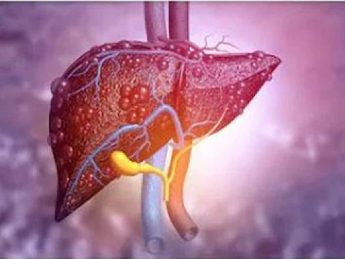 Major risk factors for development of liver cancer in India