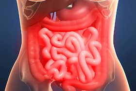 What Is Midgut Volvulus? Know Its Symptoms, Causes  And  Treatment