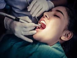 4 Most Common Oral Diseases: Causes And Prevention