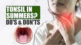 Sore Throat: Foods To Eat & Avoid When You Are Having Tonsils In Summer, Watch Video