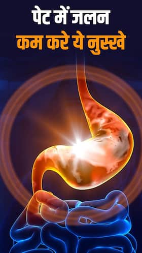 Stomach irritation : पेट में जलन होने पर अपनाए ये 6 नुस्खे