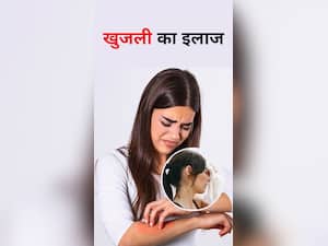 Sweat Itching : पसीने की खुजली शांत करने के उपाय