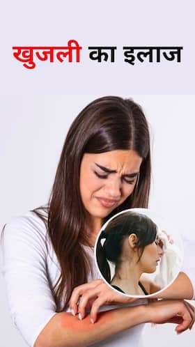 Sweat Itching : पसीने की खुजली शांत करने के उपाय Sweat Itching : पसीने की खुजली शांत करने के उपाय