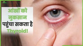 Thyroid Eye Disease: जानें कैसे सेहत के साथ आपकी आंखों पर भी बुरा असर डाल सकता है Thyroid? Watch Video Thyroid Eye Disease: जानें कैसे सेहत के साथ आपकी आंखों पर भी बुरा असर डाल सकता है Thyroid? Watch Video