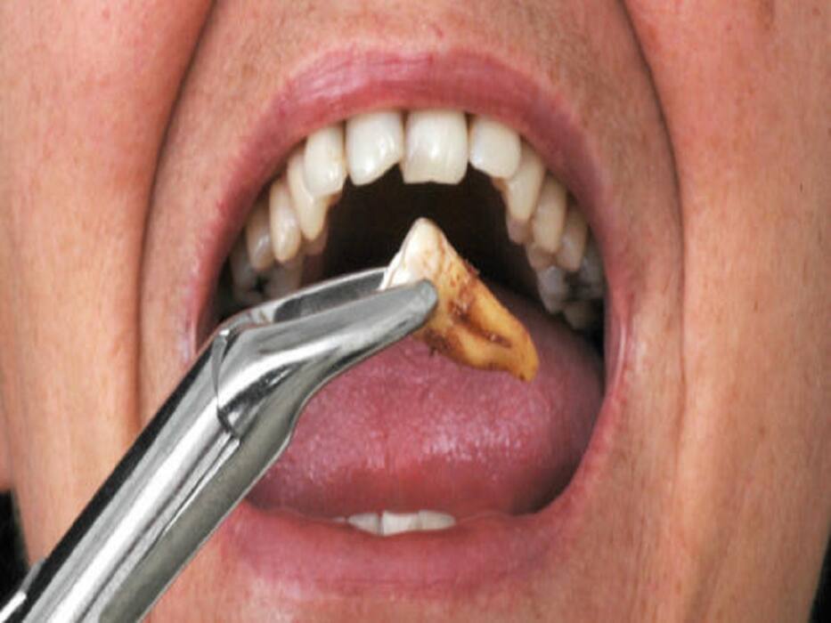 4 Most Common Oral Diseases: Causes And Prevention