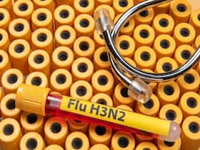 New Chip-Based RT-PCR Test Can Diagnose H3N2/H1N1 In Just An Hour New Chip-Based RT-PCR Test Can Diagnose H3N2/H1N1 In Just An Hour