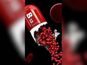 10 Vitamin B12 Deficiency Symptoms That Appear In Skin