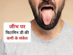 जीभ में नजर आए ये लक्षण तो हो सकते हैं विटामिन डी की कमी के संकेत, जानिए कमी दूर करने के उपाय
