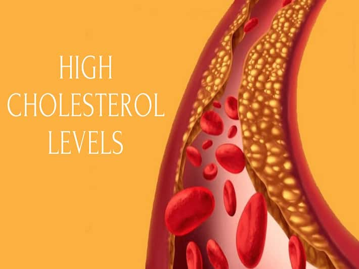 7 Amazing Home Remedies for High Cholesterol | TheHealthSite.com