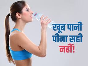 खूब सारा पानी पीने नहीं बनेगी बात! एक्सपर्ट ने बताया कितना और कैसे पीना चाहिए पानी