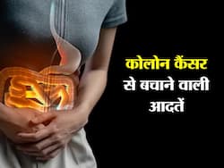 कोलोन कैंसर से बचाती हैं ये 5 हेल्दी हैबिट्स, जानें कैसे कम किया जा सकता है Colon कैंसर का रिस्क