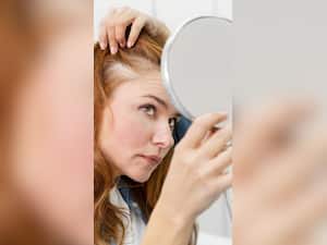 7 Ways To Prevent Your Scalp from Ageing