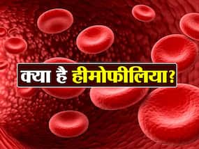 छोटी सी चोट लगने पर भी बंद नहीं होती ब्लीडिंग तो हो सकता है हीमोफीलिया, जानें इसके कुछ शुरुआती लक्षण