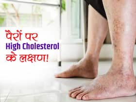 कोलेस्ट्रॉल बढ़ने पर महीने भर पहले पैरों में होते हैं ये 4 बदलाव! पैर से पता लगाएं जानलेवा हो गया Cholesterol