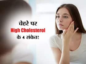 चेहरे पर दिखने वाले ये 4 संकेत मतलब High Cholesterol! जानें कहां दिखता है सबसे पहले बढ़ा हुआ कोलेस्ट्रॉल