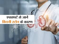 नॉर्थ इंडिया में बहुत कॉमन है Kidney stones, डॉक्टर से बताया किन कारणों से बढ़ता है किडनी स्टोन का खतरा
