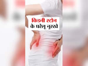 किडनी स्टोन के 8 घरेलू उपाय