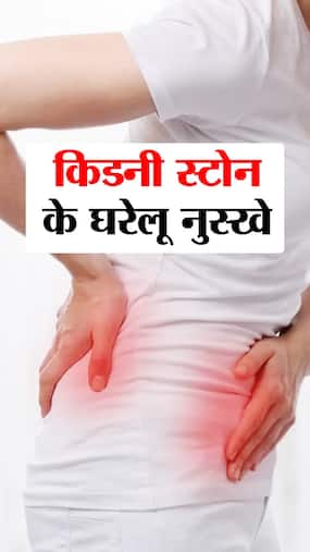 किडनी स्टोन के 8 घरेलू उपाय