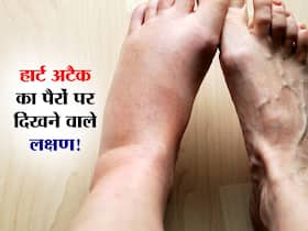पैरों में ये लक्षण बताता है बस आने ही वाला है हार्ट अटैक! जानें पैरों को देखकर हार्ट अटैक का अंदाजा लगाने वाला संकेत