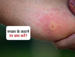 मलेरिया का मच्छर छू नहीं पाएगा करेंगे डॉक्टर के बताए ये 3 काम! जानें मच्छर के काटने पर पहला काम कौन सा जरूरी