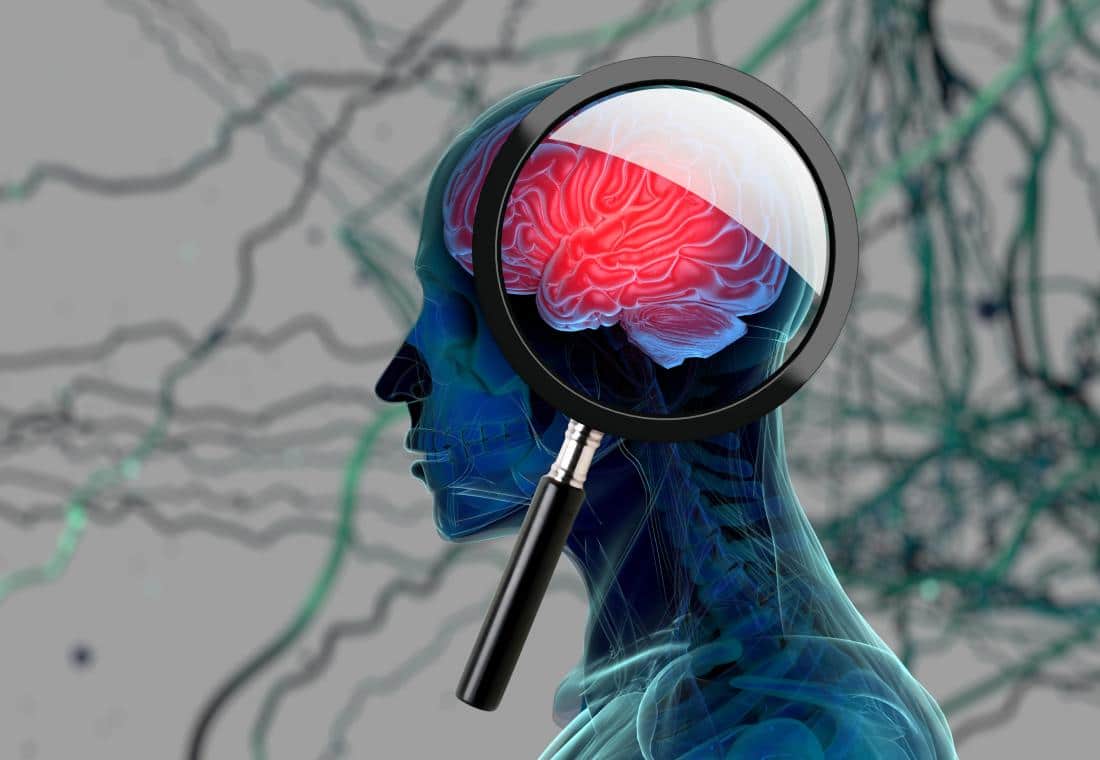 Can Parkinson’s Disease Cause Permanent Damage To The Brain? Know From The Doctor