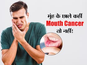 कहीं मुंह में बनने वाले छाले Mouth cancer का संकेत तो नहीं, डॉक्टर ने बताया किन बातों का रखें ध्यान कहीं मुंह में बनने वाले छाले Mouth cancer का संकेत तो नहीं, डॉक्टर ने बताया किन बातों का रखें ध्यान