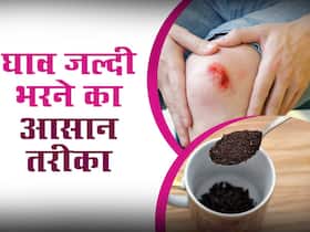 त्वचा पर बने घाव को चंद दिनों में सुखा देगी घर पर रखी ये चीज, बस पता होना चाहिए इस्तेमाल का सही तरीका