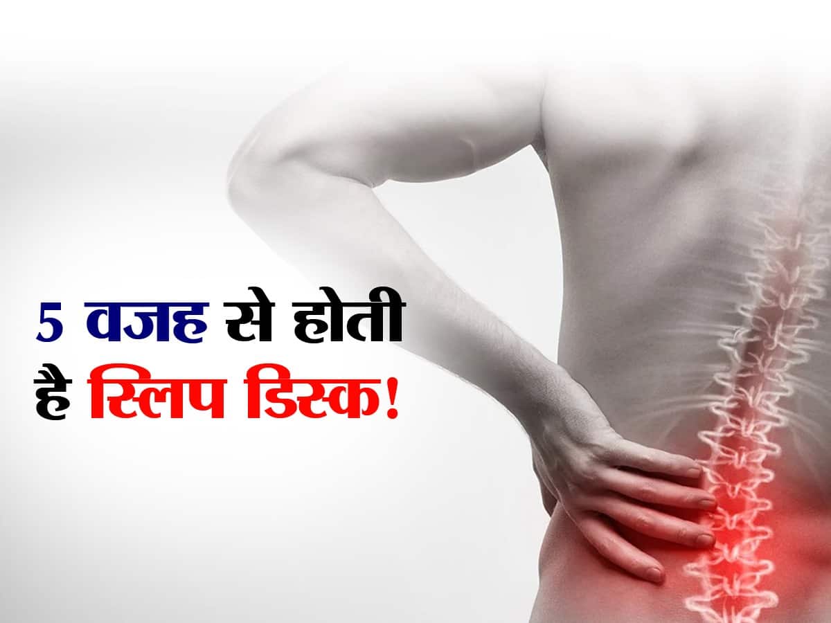 Slip Disc डेली रूटीन में इन 5 वजह से हो रही Slip Disc की परेशानी