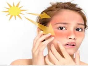 Onset Of Summer 2023: How To Care For Skin?