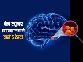 ब्रेन ट्यूमर का पता लगाने में मदद करेंगे ये 5 टेस्ट! जानें कौन सा टेस्ट ट्यूमर का पता लगाने में सबसे सटीक
