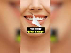 दांत का पीलापन दूर करने के नेचुरल तरीके