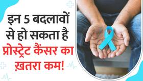 बढ़ रहा है Prostate Cancer का खतरा! इन बातों का रखें खास ध्यान