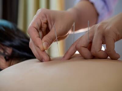 Acupuncture for Hypertension: How Does It Work?