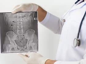 Ankylosing Spondylitis: A Complex Disease That Can Cause Serious Heart Diseases Ankylosing Spondylitis: A Complex Disease That Can Cause Serious Heart Diseases
