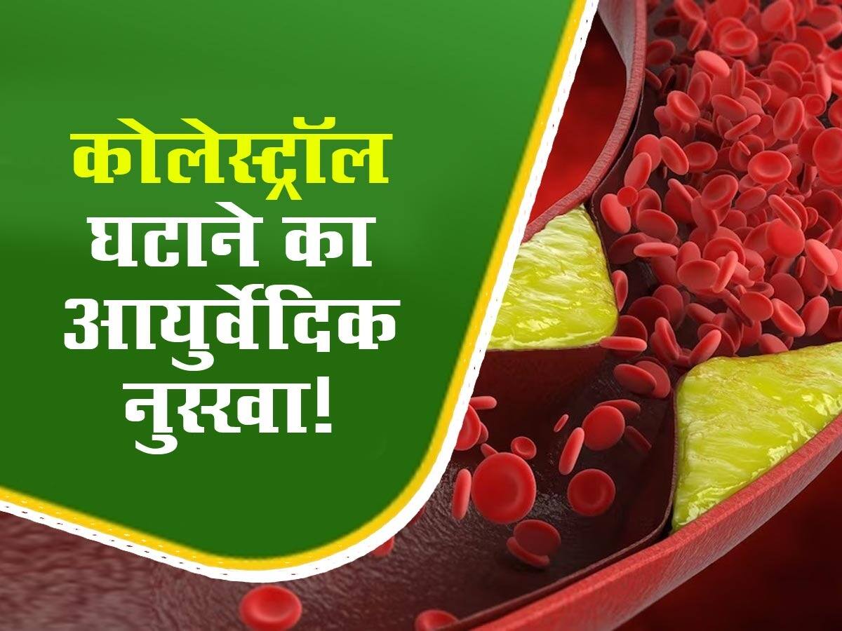 Cholesterol Kam Karne ke Upay नसों में खराब कोलेस्ट्रॉल को निचोड़कर