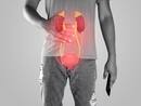 Screen Now To Save Lives: Detection In Early 30s For Chronic Kidney Disease