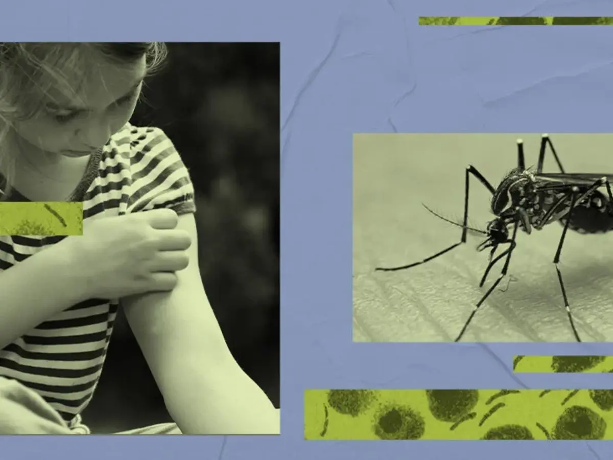 7 síntomas inusuales de infección por el virus del dengue que no debes ignorar