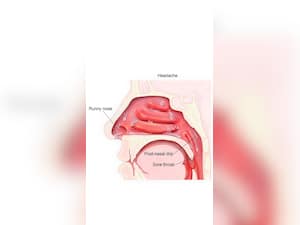Mucus In Throat And Nose: 5 Foods To Eat And Avoid