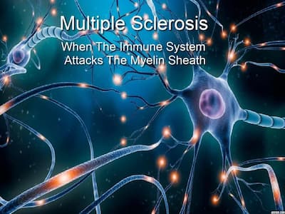 Exclusive Interview: Unmasking Multiple Sclerosis And Understanding The Invisible Battle