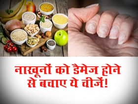 अचानक से पीले-पीले होकर टूट रहे हैं आपके नाखून? डाइट में तुरंत शामिल करें ये फूड्स 