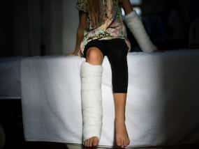 Osteogenesis Imperfecta (Brittle Bone Disease): OI Warrior Shares Her Struggle With The Condition
