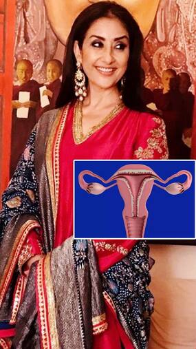 Ovarian Cancer : ये 7 सेलिब्रिटीज दे चुके हैं ओवेरियन कैंसर को मात
