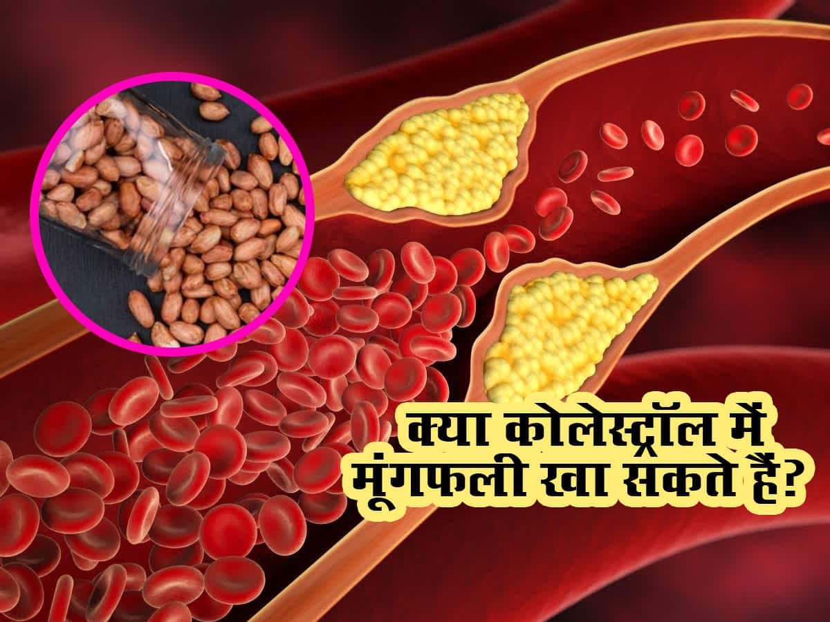 Peanuts for High Cholesterol क्या हाई कोलेस्ट्रॉल में मूंगफली खा सकते