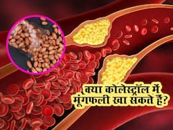 क्या हाई कोलेस्ट्रॉल में मूंगफली खा सकते हैं? जानिए एक्सपर्ट की क्या है राय