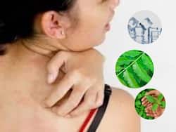 गर्मियों में बच्चे ही नहीं बुजुर्ग भी चुभती घमौरियों से रहते हैं परेशान, इन नुस्खों से तुरंत पाएं आराम