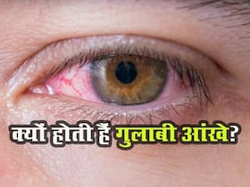 आंखें बार-बार गुलाबी होना हो सकता है इस बीमारी का संकेत, जानें कारण और बचाव के टिप्स